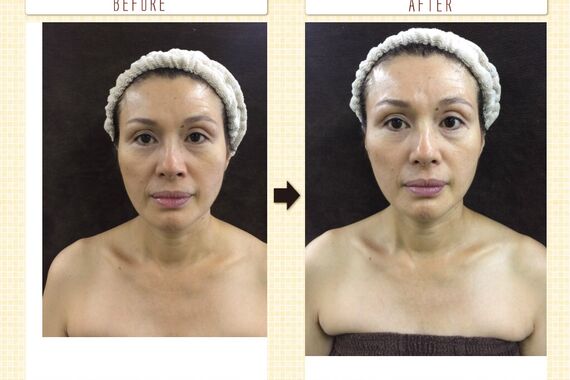 F2D532BE-852C-42E4-BDF6-DBA0E6FBA616